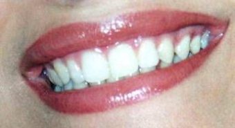 Dentista senza prenotazione a Roma, all'Isola Tiberina visite immediate per urgenze e controlli