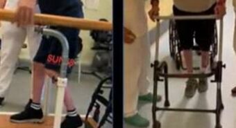 Neurostimolatore midollare fa tornare a camminare due pazienti, è la prima volta