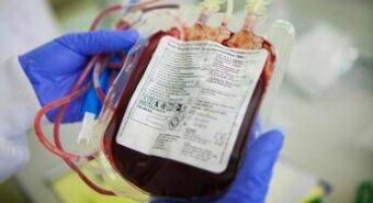 Tumori, da cordone ombelicale donato ecco cellule Carcik: nuova arma contro leucemia