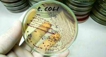 Da salmonella a listeria a E.Coli, ipotesi in campo in tossinfezioni alimentari