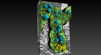 Rivelato il legame intestino-cervello nell’Alzheimer grazie ai raggi X