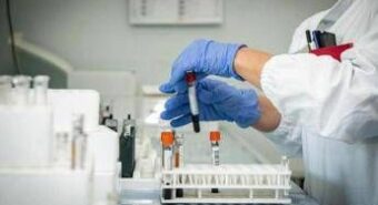 Aids, al Croi 2025 primi dati su PrEP da somministrare 1 volta l’anno