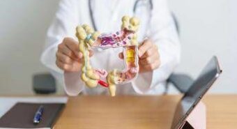 Cancro metastatico colon retto, campagna ‘Più cura. Più tempo. Più vita’