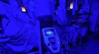 Chirurgia, all’Ismett di Palermo bypass aorto coronarico con robot, primo al Sud