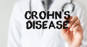 Farmaci, ok Ue per trattamento malattia di Crohn nei pazienti adulti