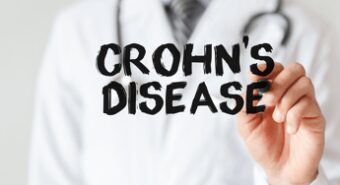 Malattia di Crohn, circa 15 mila pazienti in Emilia Romagna e 7mila in Piemonte