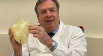 Medicina: prima mondiale a Padova, esiti infezione aspirati da aorta a cuore battente