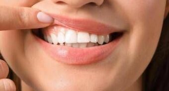 Salute ‘in 70% persone con autismo problemi a denti e gengive’, parodontologi in campo