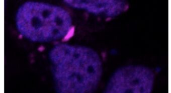Ia, algoritmo Iit va a caccia di proteine dannose per il cervello