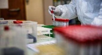 Covid, negli Usa avanza la variante Cicada: perché BA.3.2 preoccupa gli esperti