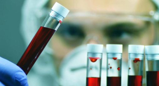 Leucemia linfatica cronica, con zanubrutinib sopravvivenza al 74% a 6 anni Leucemia linfatica cronica, con zanubrutinib sopravvivenza al 74% a 6 anni