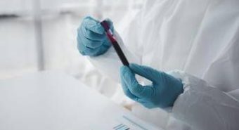 Epatite A in forte crescita in Italia: Lazio, Campania e Puglia le regioni con più casi Epatite A in forte crescita in Italia: Lazio, Campania e Puglia le regioni con più casi