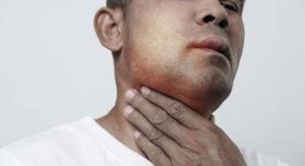 Angioedema ereditario, Aifa estende uso lanadelumab dai 2 anni di età