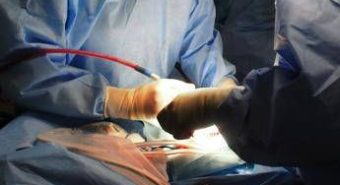 Interventi aorta, 2 studi ‘prevedono’ pazienti più a rischio mortalità
