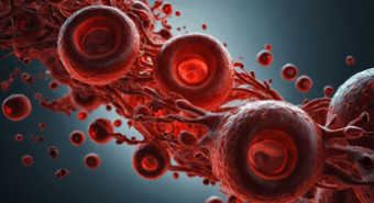 Mieloma multiplo, rimborso per Car-T cilta-cel nella seconda linea di trattamento