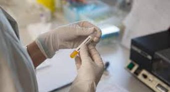 Cancro prostata metastatico ormonosensibile, nuovi dati su darolutamide mostrano benefici in sopravvivenza Cancro prostata metastatico ormonosensibile, nuovi dati su darolutamide mostrano benefici in sopravvivenza