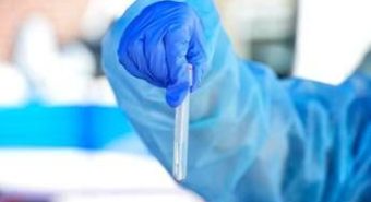 Hantavirus, il punto: contagio e sintomi, cosa c'è da sapere e come proteggersi