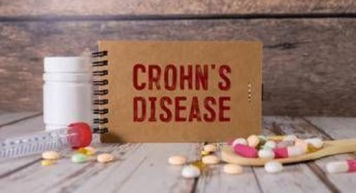 Malattia Crohn con fistole, nuovi dati su terapia monoclonale
