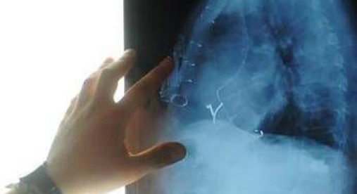 Radiologia interventistica, Ssn e fondazioni per cure più accessibili